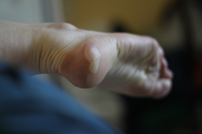 La préparation des pieds à un effort long