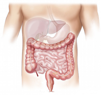 Perméabilité intestinale: les sports d'endurance, un facteur aggravant !!!
